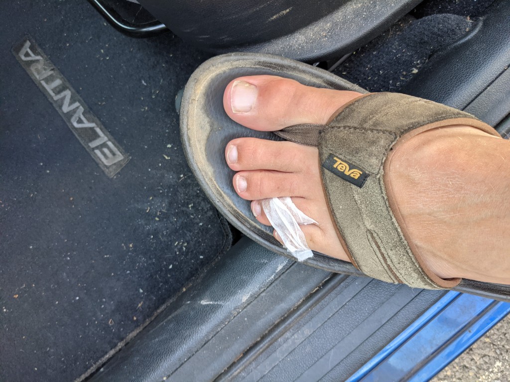 My broken pinkie toe